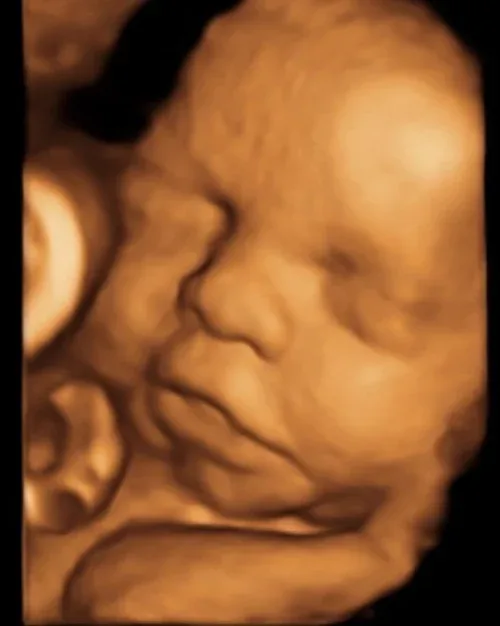 3D ultrasound of a baby smiling