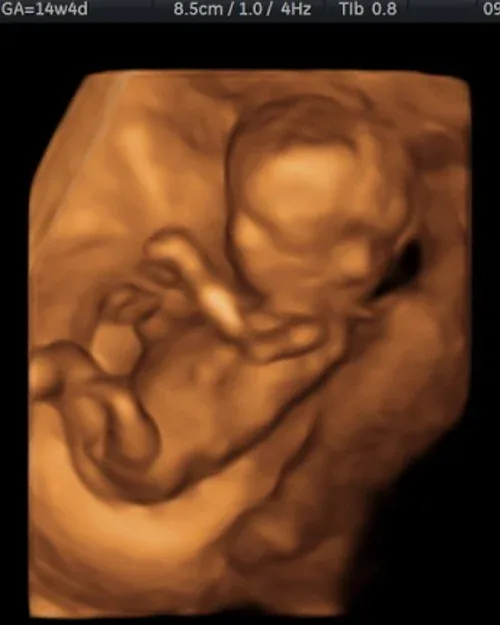 3D ultrasound baby profile at 30 weeks
