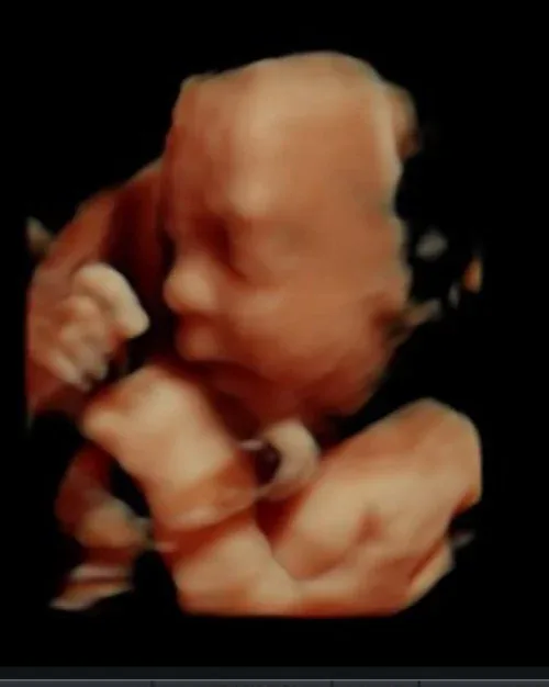 3D ultrasound baby resting