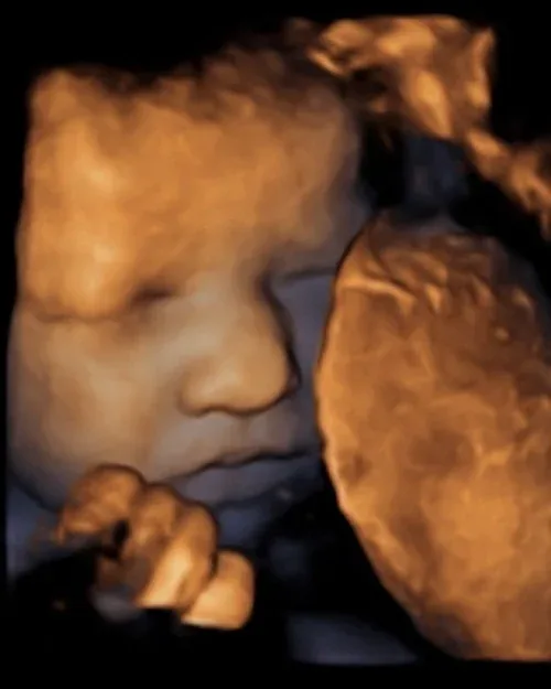 4D ultrasound baby face close up