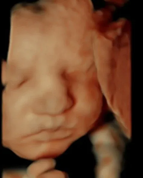 Keepsake HD Live Experience ultrasound at A Future Look in Jackson, Ohio