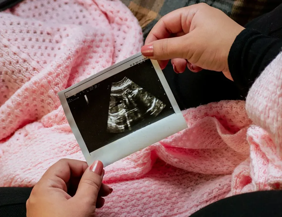Baby's First Look ultrasound at A Future Look in Jackson, Ohio